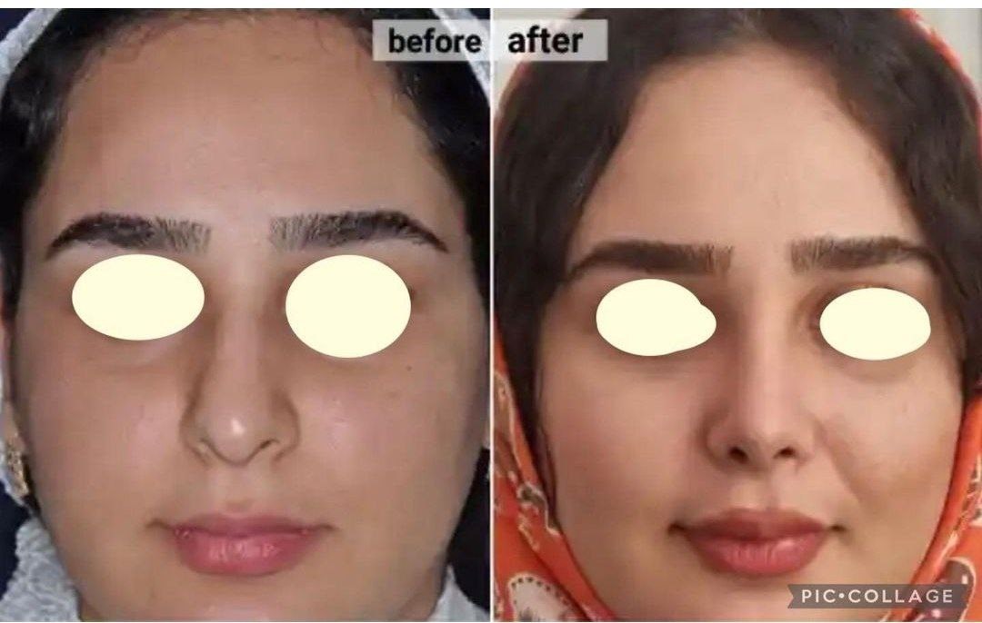 Doctoryab Iran